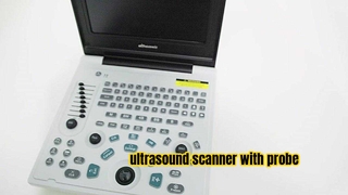 Saferlife medizinische Geräte Ultraschallscanner